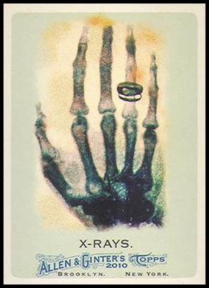 185 X-Rays